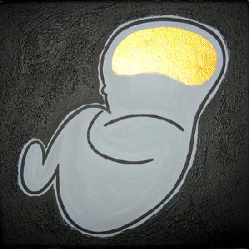 Andrea Mattiello: Croce Delizia